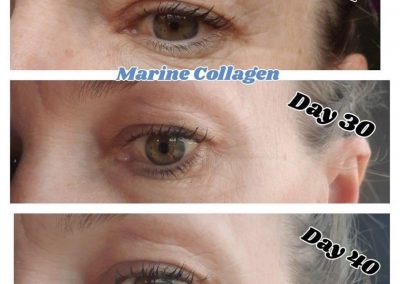 Marine Collagen Elixir Before & After reduced fine lines around the eyes