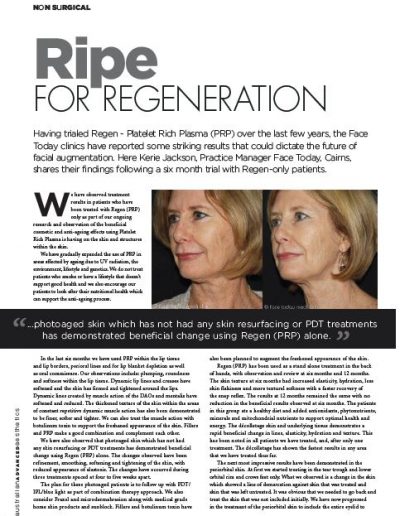 Ripe for Regeneration - Article by Nicki Belle