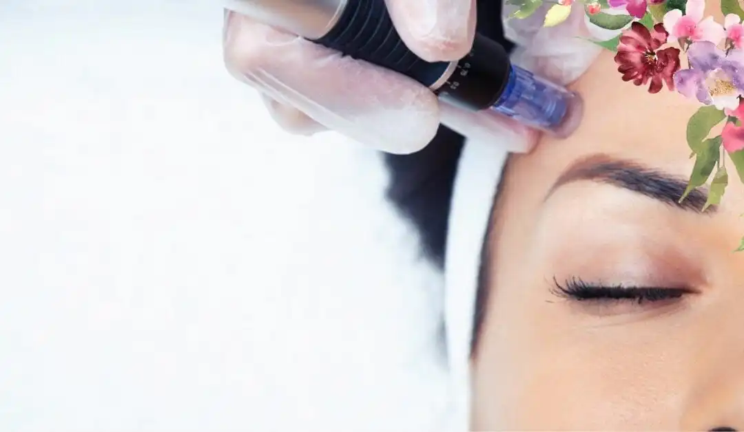 Top 5 reasons why you should try Skin Needling with Dermapen.