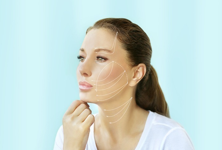 thread lift procedure ,non-surgical facelift,markup