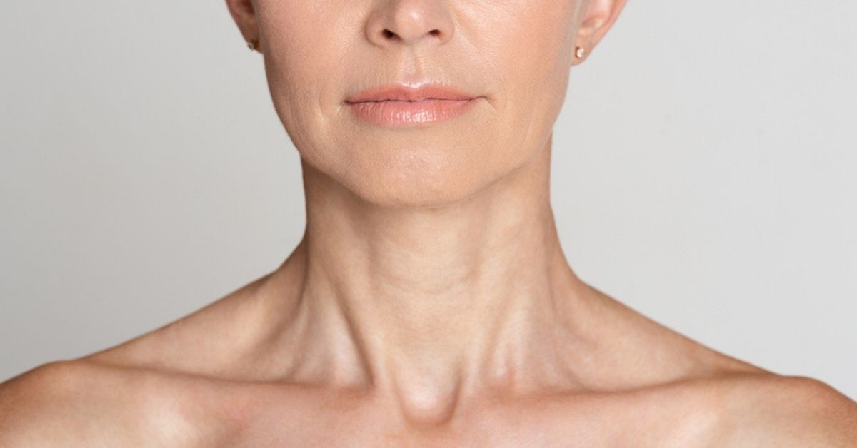 neck ageing