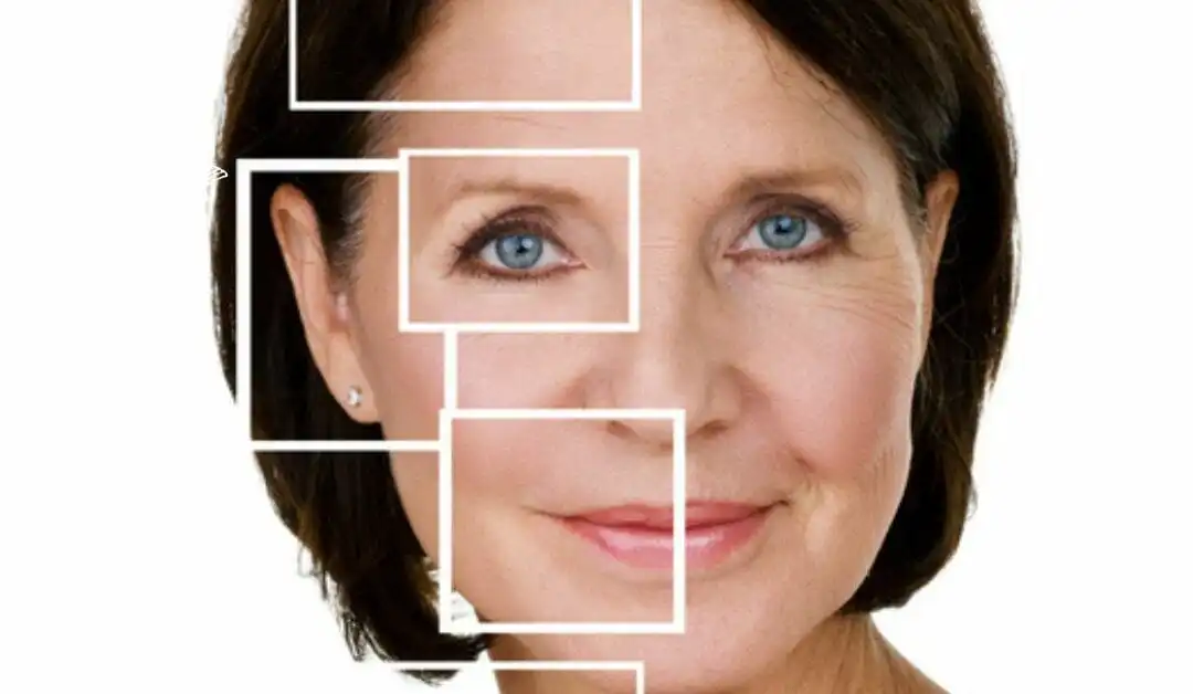 Most Frequently asked questions No. 3 – Hooded, Puffy, Sagging Upper Eyelids.