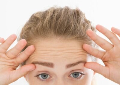 Most Frequently asked Questions – No. 4 – Forehead Lines.