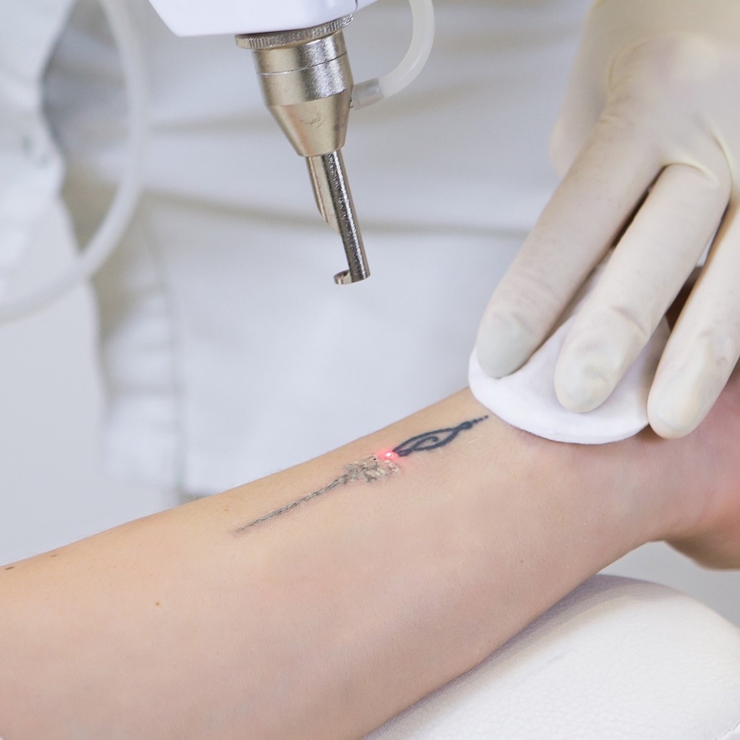 Age Amazingly Non Surgical Facelift