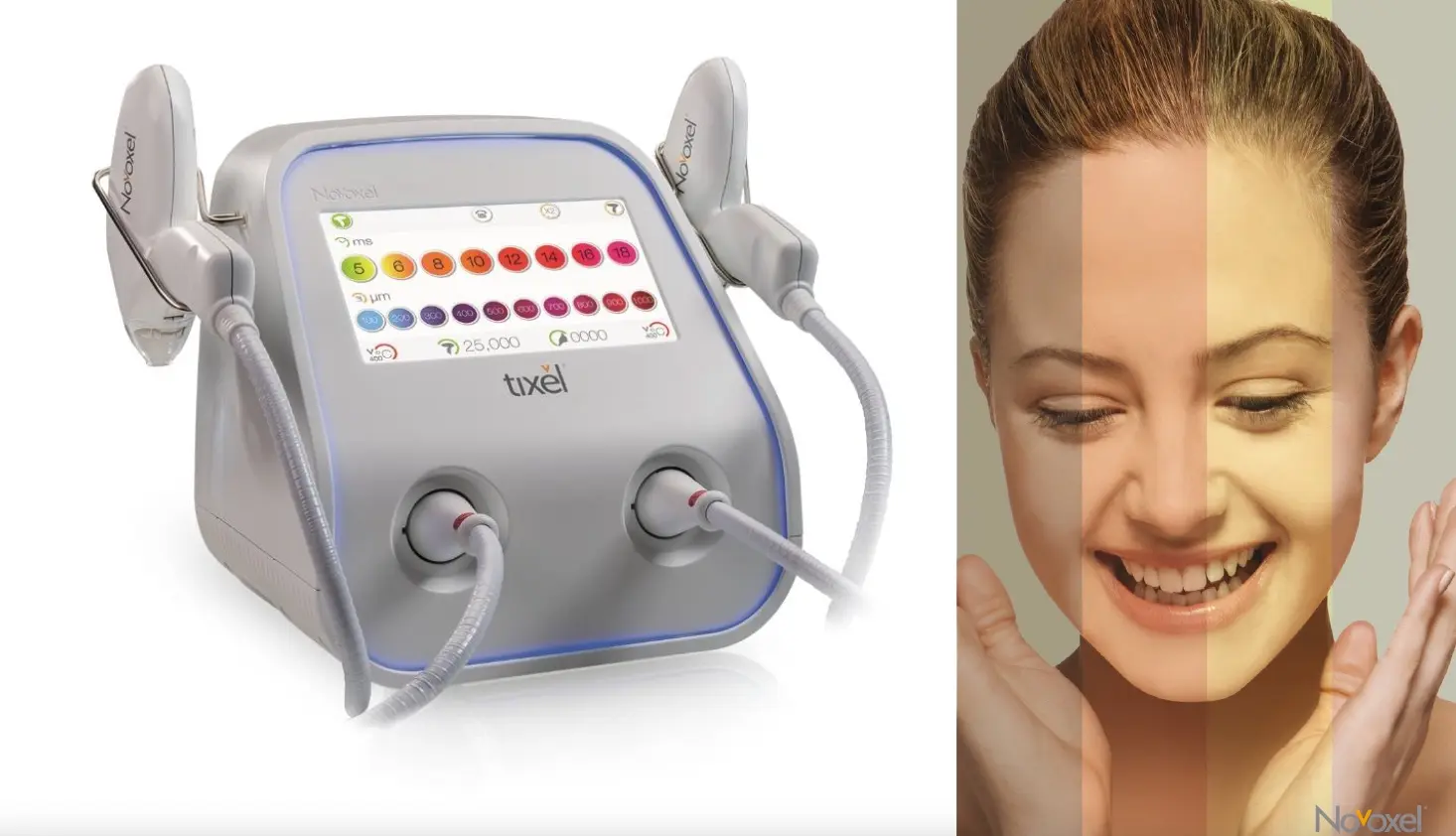 Tixel heat-based skin rejuvenation device, treatment areas illustrated